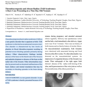 Thrombocytopenia and Absent Radius (TAR Syndrome): A Rare Case Presenting in a Nine Day Old Neonate