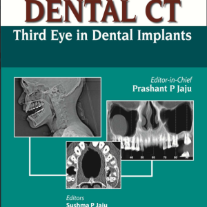 DENTAL CT THIRD EYE IN DENTAL IMPLANTS